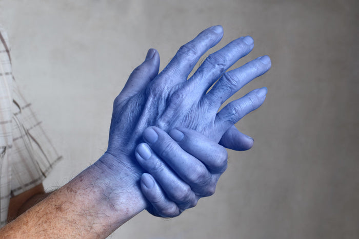 Blue colored hands to represent cold.